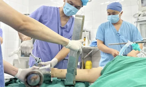 Một phút bất cẩn bên máy xay thịt, người phụ nữ trẻ phải trả giá đắt