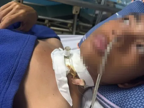 Cứu sống nam thanh niên bị đứt khí quản do vướng phải dây điện