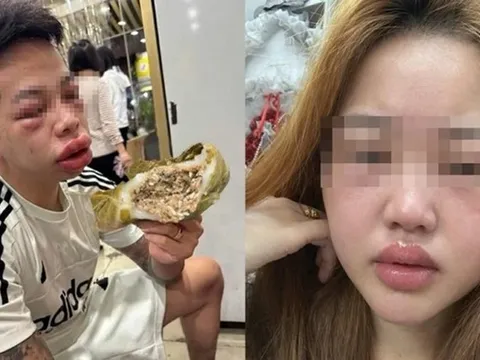 Ăn món "lạ" người phụ nữ mặt sưng húp, bác sĩ chỉ mặt điểm tên lý do cực độc