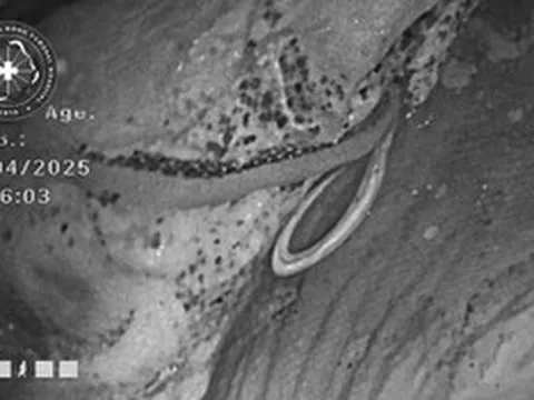 Đi siêu âm, người đàn ông chết lặng khi phát hiện sinh vật “đáng sợ” trong bụng